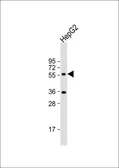 Anti-CYP7A1 antibody, C-term used in Western Blot (WB). GTX81230