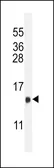Anti-LH beta antibody, C-term used in Western Blot (WB). GTX81236