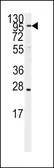 Anti-ERAP1 antibody, Internal used in Western Blot (WB). GTX81263
