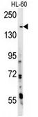 Anti-PHLPP2 antibody, N-term used in Western Blot (WB). GTX81285