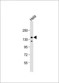Anti-IRS2 antibody, C-term used in Western Blot (WB). GTX81291