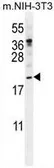 Anti-Pleiotrophin antibody, N-term used in Western Blot (WB). GTX81295