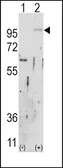 Anti-FGFR2 antibody used in Western Blot (WB). GTX81341
