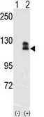 Anti-EphB2 antibody used in Western Blot (WB). GTX81348