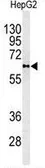 Anti-PLTP antibody, C-term used in Western Blot (WB). GTX81352