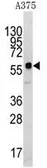 Anti-KREMEN1 antibody, N-term used in Western Blot (WB). GTX81373