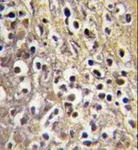 Anti-Aromatase antibody, C-term used in IHC (Paraffin sections) (IHC-P). GTX81387
