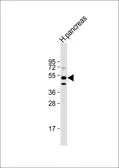 Anti-GIPR antibody, Internal used in Western Blot (WB). GTX81409