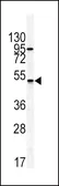Anti-GIPR antibody, N-term used in Western Blot (WB). GTX81410