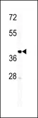 Anti-IGHM antibody, N-term used in Western Blot (WB). GTX81430