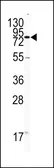 Anti-CD31 antibody, C-term used in Western Blot (WB). GTX81432