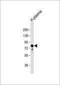 Anti-Vitronectin antibody, N-term used in Western Blot (WB). GTX81434