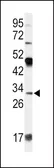 Anti-Apolipoprotein D antibody, N-term used in Western Blot (WB). GTX81463