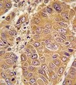 Anti-Apolipoprotein A1 antibody, N-term used in IHC (Paraffin sections) (IHC-P). GTX81467
