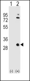 Anti-Apolipoprotein A1 antibody, N-term used in Western Blot (WB). GTX81467