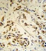 Anti-RBM3 antibody, Internal used in IHC (Paraffin sections) (IHC-P). GTX81472