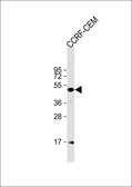Anti-n-Myc antibody, C-term used in Western Blot (WB). GTX81475
