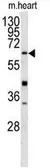 Anti-GGT5 antibody, N-term used in Western Blot (WB). GTX81477