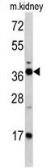 Anti-FBP1 antibody, Internal used in Western Blot (WB). GTX81482