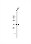 Anti-FBP1 antibody, N-term used in Western Blot (WB). GTX81483