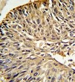 Anti-DHFR antibody, C-term used in IHC (Paraffin sections) (IHC-P). GTX81492