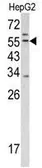 Anti-TMPRSS2 antibody, Internal used in Western Blot (WB). GTX81494