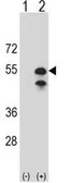 Anti-CPN1 antibody, N-term used in Western Blot (WB). GTX81518