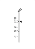 Anti-HRG antibody, N-term used in Western Blot (WB). GTX81528