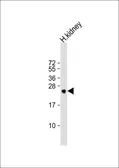 Anti-MSRA antibody, N-term used in Western Blot (WB). GTX81531