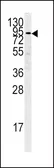 Anti-PLG antibody, C-term used in Western Blot (WB). GTX81534