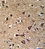 Anti-Glutaredoxin 2 antibody, C-term used in IHC (Paraffin sections) (IHC-P). GTX81538