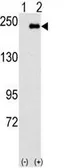 Anti-JLP antibody, N-term used in Western Blot (WB). GTX81548