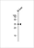 Anti-HMX2 antibody, C-term used in Western Blot (WB). GTX81571