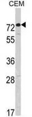 Anti-AMHR2 antibody, C-term used in Western Blot (WB). GTX81590