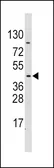 Anti-PDK4 antibody used in Western Blot (WB). GTX81597