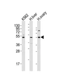 Anti-LAG3 antibody, Internal used in Western Blot (WB). GTX81605