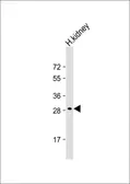 Anti-DIO1 antibody, N-term used in Western Blot (WB). GTX81625
