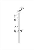 Anti-IGFBP4 antibody, N-term used in Western Blot (WB). GTX81639