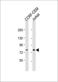 Anti-ND5 antibody, C-term used in Western Blot (WB). GTX81641