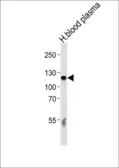 Anti-C6 antibody, N-term used in Western Blot (WB). GTX81643