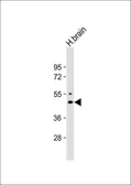 Anti-Kir2.1 antibody, C-term used in Western Blot (WB). GTX81647