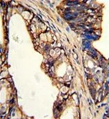 Anti-TGM4 antibody, Internal used in IHC (Paraffin sections) (IHC-P). GTX81652