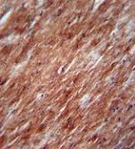 Anti-IL2 antibody, Internal used in IHC (Paraffin sections) (IHC-P). GTX81656