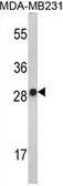 Anti-IL2 antibody, Internal used in Western Blot (WB). GTX81656