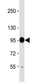 Anti-COMP antibody, Internal used in Western Blot (WB). GTX81660