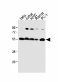 Anti-Calreticulin antibody, Internal used in Western Blot (WB). GTX81663
