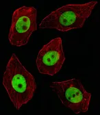 Anti-TFII-I antibody, C-term used in Immunocytochemistry/ Immunofluorescence (ICC/IF). GTX81672