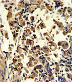 Anti-SOD3 antibody, N-term used in IHC (Paraffin sections) (IHC-P). GTX81678