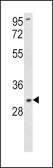 Anti-SOD3 antibody, N-term used in Western Blot (WB). GTX81678
