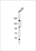 Anti-CORIN antibody, Internal used in Western Blot (WB). GTX81681